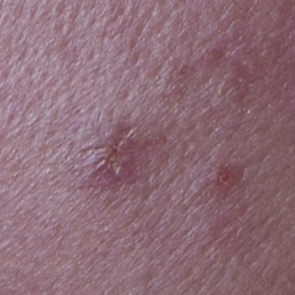 creama liftactiv specialist